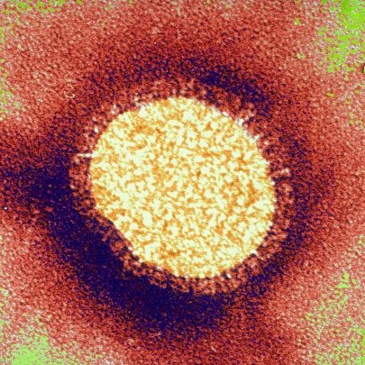 Influenza virus staand