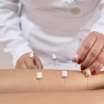 Ontstekingsremmend dieet en acupunctuur tegen depressie bij diabetes 3