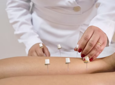 Ontstekingsremmend dieet en acupunctuur tegen depressie bij diabetes 20