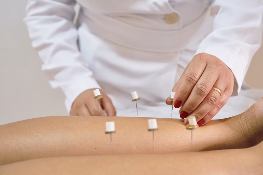 Ontstekingsremmend dieet en acupunctuur tegen depressie bij diabetes 3 Ontstekingsremmend dieet en acupunctuur tegen depressie bij diabetes 3