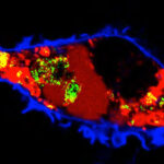 Hoe hoog cholesterol uitzaaiingen bevordert 4