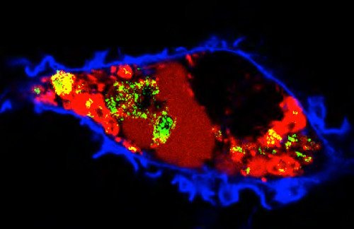 Hoe hoog cholesterol uitzaaiingen bevordert 3