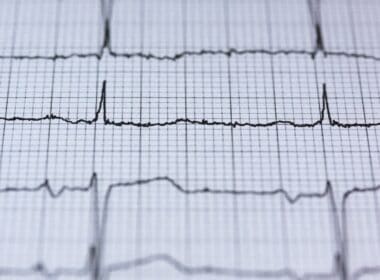 Nederland beste land om een hartaanval te krijgen 11