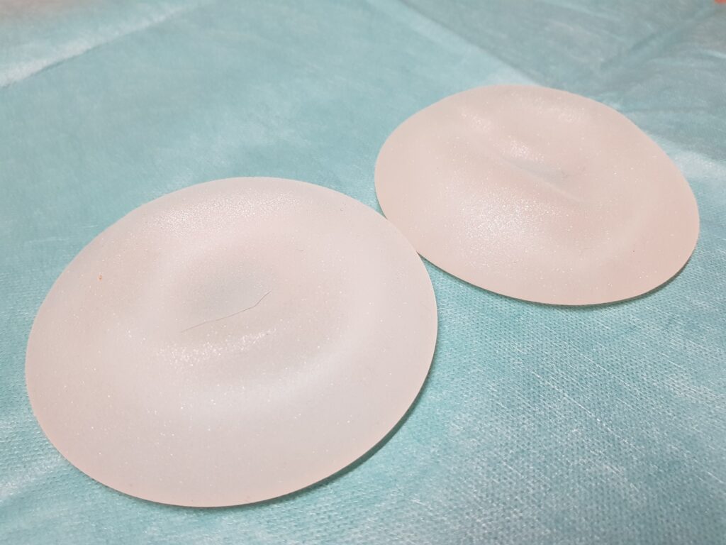 Siliconen borstprothesen onveilig: 'Alle vrouwen krijgen de rekening gepresenteerd' 4