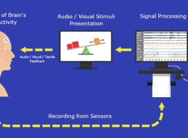 Neurofeedback tegen ‘chemobrein’ 11