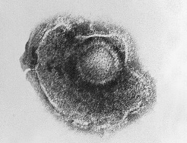 Link tussen virussen, progressieve hersenziekten en kanker 7