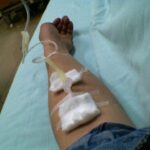 Chemo's bezorgen Kirsten al 34 jaar klachten 16