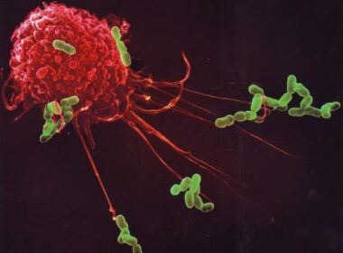 Coronapatiënten overlijden niet aan het virus per sé, maar aan een overactief immuunsysteem 6