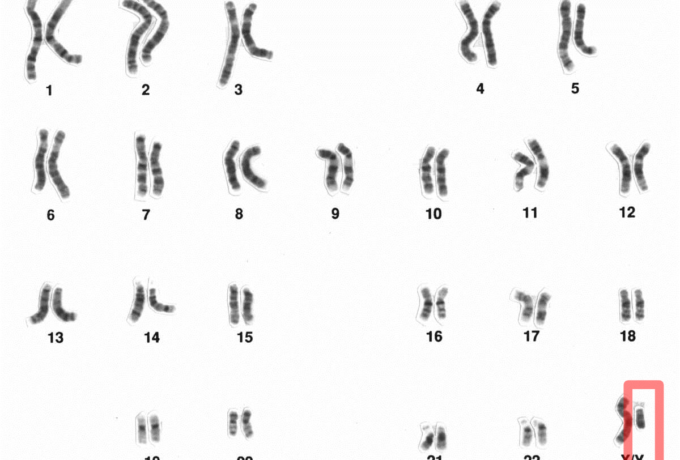 Is de man aan het verdwijnen? 12